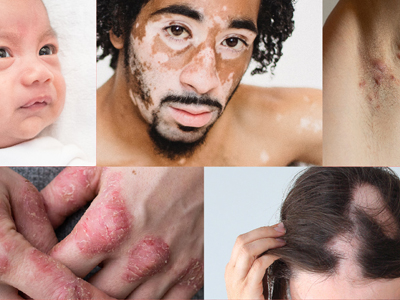 Skin Care